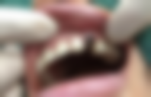 二、广东韶关明德口腔诊所医生团队,打造专精诊疗服务