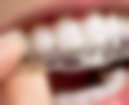 四、深贝齿口腔设备介绍