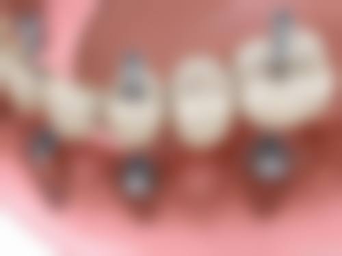 七、重庆维恩牙得舒口腔就医指南,便捷就诊不迷路