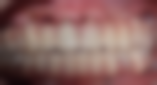 七、西安未央美雅口腔诊所就医指南,便捷就诊不迷路