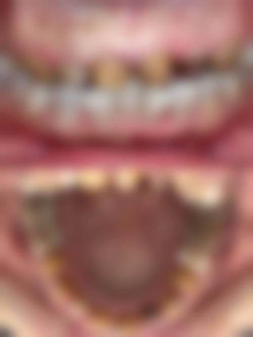 四、江西上饶余干县康雅口腔设备介绍