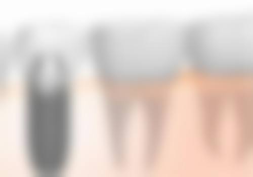 二、隆回雅贝康口腔医院医生团队,打造专精诊疗服务