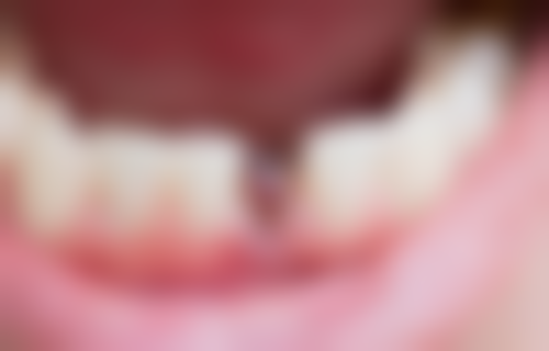 二、浙江绍兴柯美口腔医生团队,打造专精诊疗服务