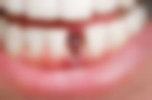 高难度种植的优缺点分析