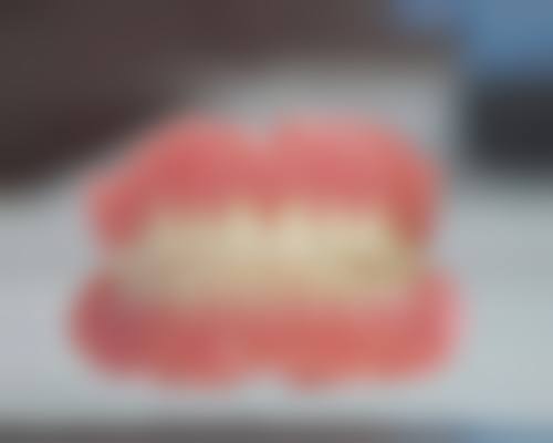 复杂牙齿矫正的优缺点分析