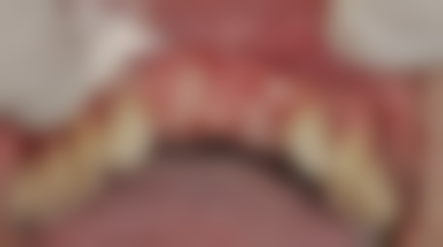 四、洛川王玉娟口腔诊所设备介绍