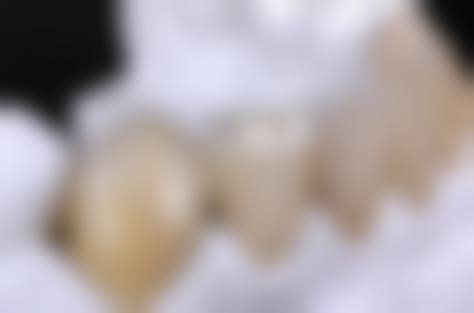 七、洛川王玉娟口腔诊所就医指南，便捷就诊不迷路