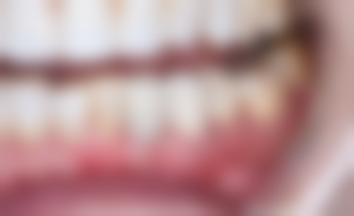 五、连云港潘加钱口腔舒适就医环境，打造人性化诊疗体验