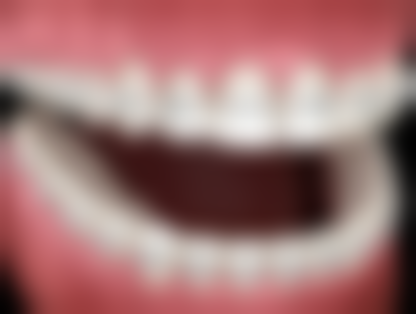 四、陕西安康爱婕牙口腔诊所设备介绍