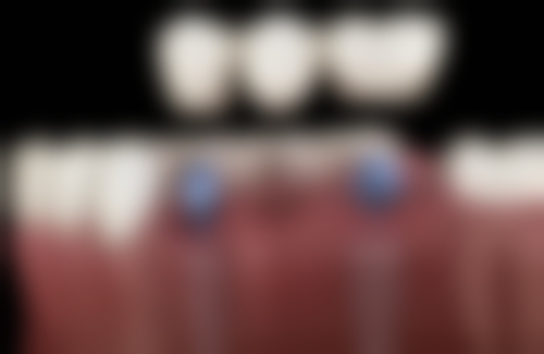 三、台州瑞佳口腔门诊核心科室与特色项目