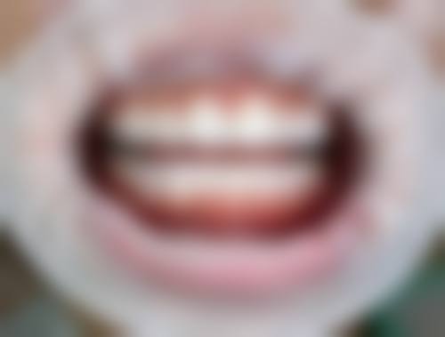 二、陕西安康汉滨区众邦口腔医生团队，打造专精诊疗服务