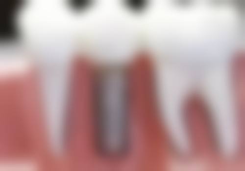 七、四川眉山恒川口腔就医指南，便捷就诊不迷路