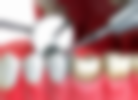 二、广州市花都区人民医院口腔科医生团队，打造专精诊疗服务