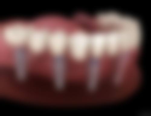 六、开平谢锦荣口腔诊所荣誉资质与患者口碑，见证品牌实力