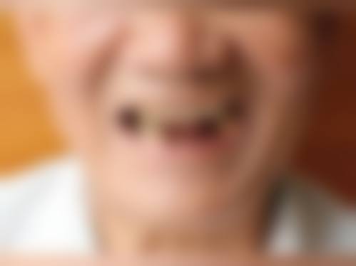 七、兰山张争光口腔诊所就医指南，便捷就诊不迷路