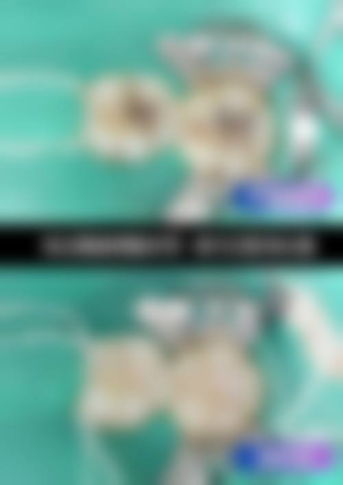 七、弋阳县佳惠口腔就医指南,便捷就诊不迷路