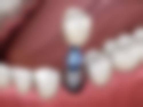 三、湖北荆州监利华玉口腔门诊部核心科室与特色项目
