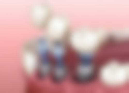 四、浙江衢州鹿鸣口腔门诊部设备介绍