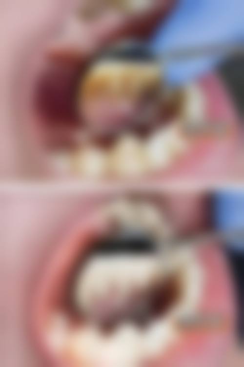 三、广东广州新悦口腔诊所核心科室与特色项目