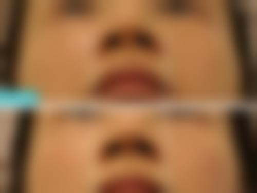 诊疗特色总结:史利医生在济南美尔雅整形美容诊所的服务理念