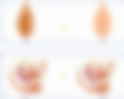 擅长项目详解:史利医生在济南美尔雅整形美容诊所的核心技术