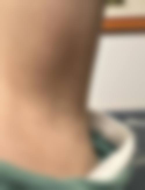 患者真实评价