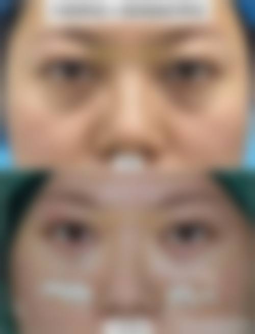 设备环境与安心保护：正版材料层流手术室