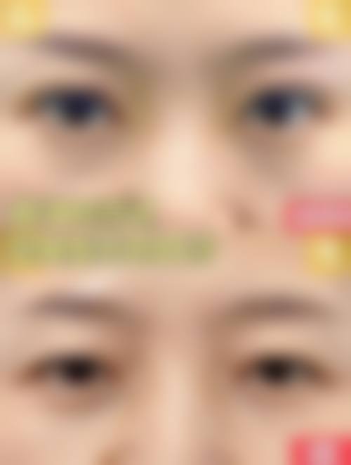 临床实例分享:史利医生在济南美尔雅整形美容诊所的真实反馈