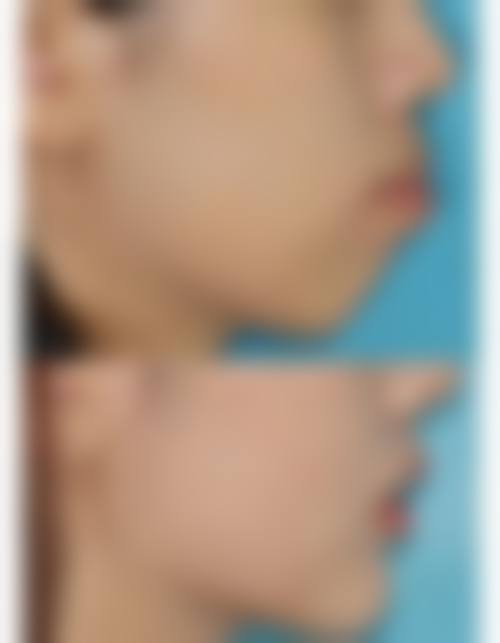结尾预约号召
