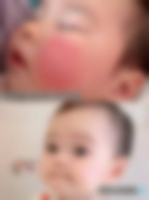 总结与预约建议