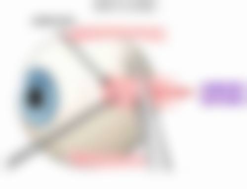 擅长项目详解:防城港市第一人民医院眼科周碧娟的技术特长