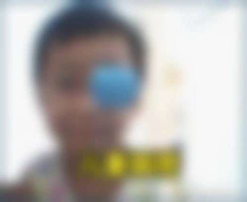 擅长项目详解:刘忠兰+宣汉县人民医院眼科