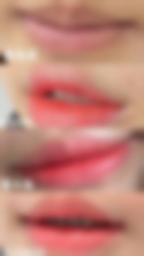诊疗特色总结:娄底美科医疗美容门诊部姜昌君医生的技术优势在哪里?