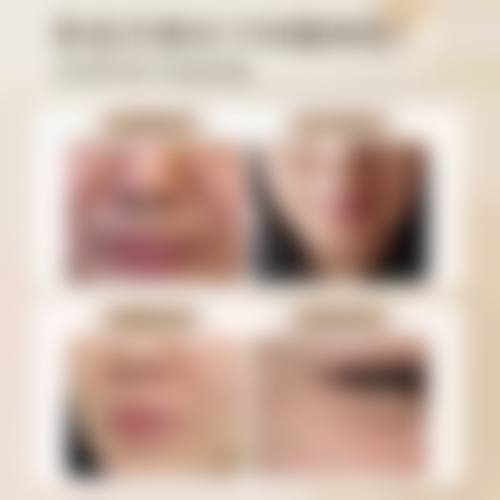 患者真实评价:娄底美科医疗美容门诊部许艳芳