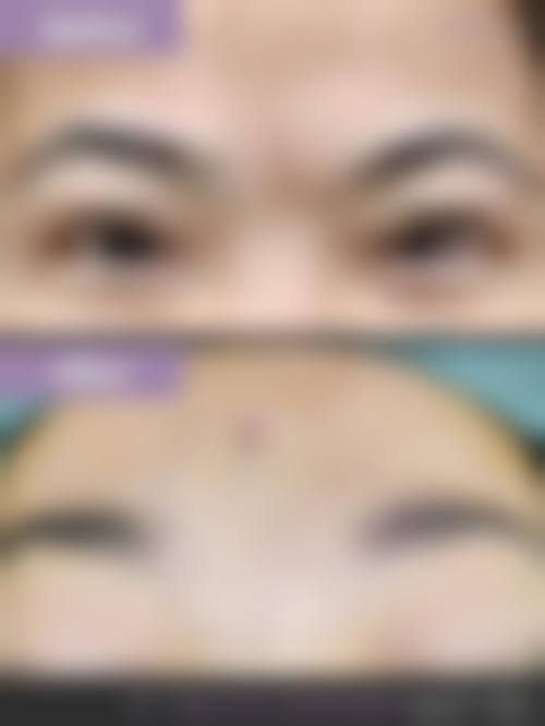 结尾预约号召:娄底美科医疗美容门诊部许艳芳