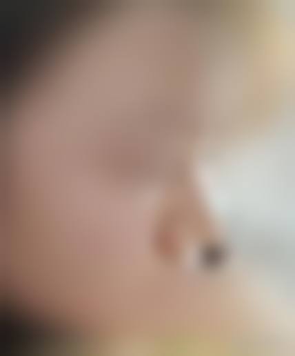 擅长项目详解：天门江岳医疗美容诊所