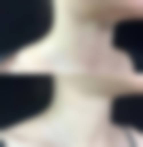 透明价格体系与优惠活动详情