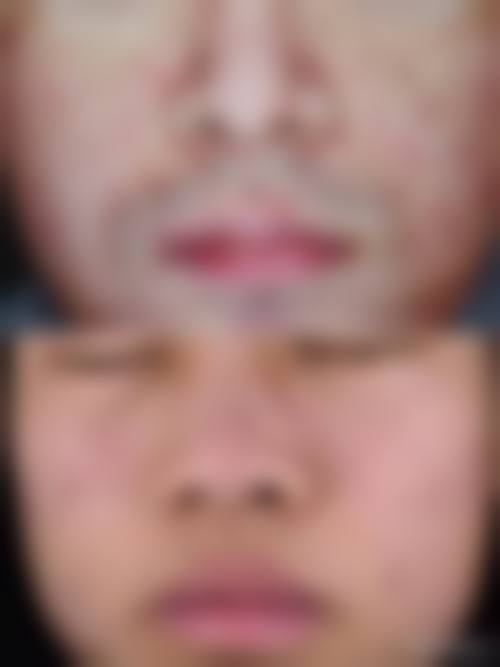 患者真实评价天津大港伊莱美医疗美容专科门诊部黄双全