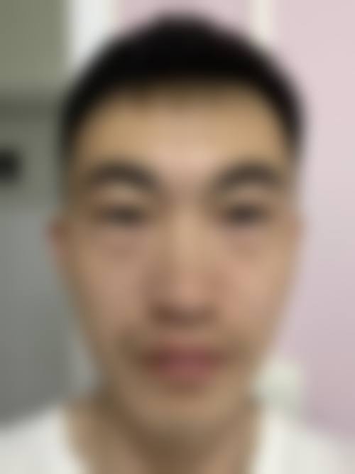 结尾预约号召：深圳明莱医疗美容诊所姜刚勇