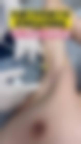 擅长项目详解：深圳明莱医疗美容诊所姜刚勇