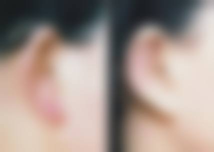 临床实例分享：真实反馈与成效呈现