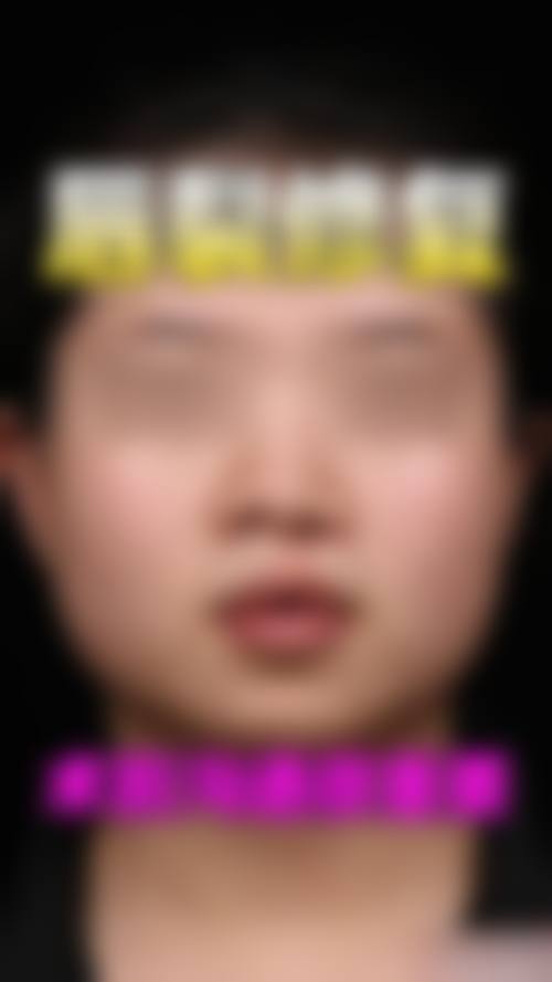 擅长项目详解：面部整形与注射美学