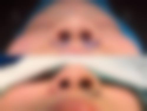 擅长项目详解：陈世俊医生擅长哪些项目？