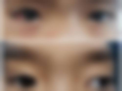 临床实例分享