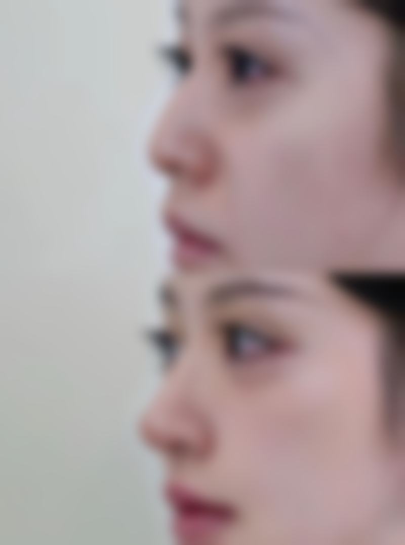 诊疗特色总结：为什么选择陈世俊医生？