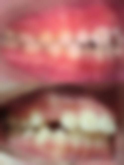 透明价格与优惠活动