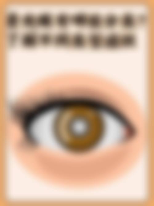 FAQ西安光彩明天儿童眼科医院吴胜望