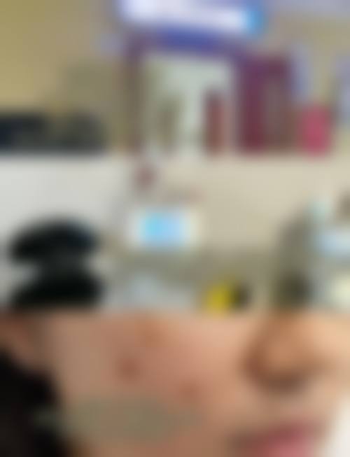 擅长项目详解