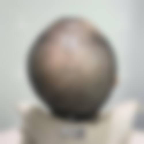 透明价格体系与优惠详情