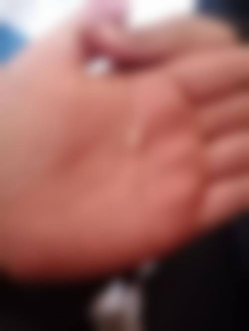 临床实例分享
